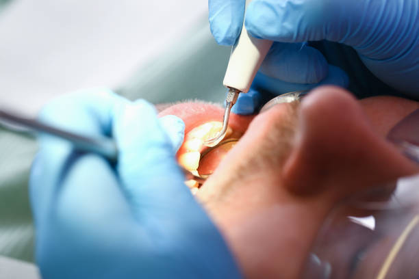 Best Urgent Tooth Repair  in Charlotte, TX